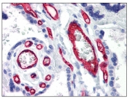 AM08318PU-N - CD34