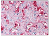 AM08319PU-N - Beta-2-microglobulin