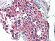 AP08840PU-N - ALDH1