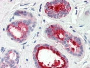 AP08841PU-N - PIP / GCDFP15