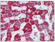 AM06065PU-N - FANCD2