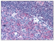 AM08347PU-N - CD40