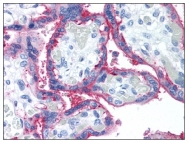 AM08350PU-N - CD59
