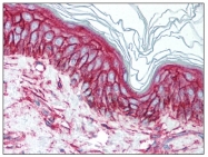 AM08351PU-N - CD9