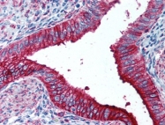 AM08357PU-N - CD15
