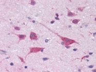 AM08365PU-N - eIF4G2 / DAP5