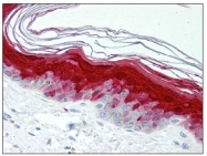 AM08369AF-N - S100A7 / Psoriasin