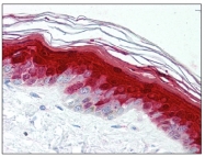 AM08370PU-N - S100A7 / Psoriasin