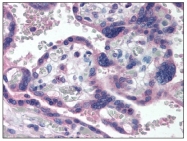 AM08372PU-N - Tumor protein p73 (TP73)