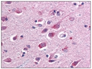 AM08374PU-N - SARM1