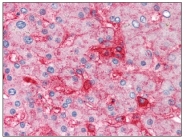 AM08384PU-N - Beta-2-microglobulin