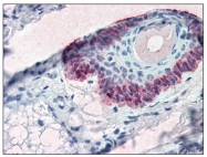 AM08390PU-N - Cytokeratin 15
