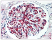 AM08396PU-N - CD31 / PECAM1