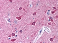 AP09041PU-N - G protein alpha inhibitor 1