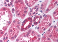 AP09041PU-N - G protein alpha inhibitor 1