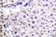 AP06609PU-N - Aurora kinase B