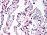 SM1182PS - CD88 / C5R1