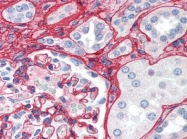 AP09015BT-N - Collagen type V