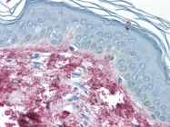 AP09013BT-N - Collagen type III alpha 1 chain