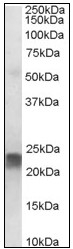 AP08876PU-N - Transgelin (TAGLN)