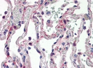 AP08877PU-N - Interleukin-27 / IL27A