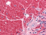 AP08999PU-N - DISC1
