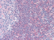 AP09004PU-N - PPP3R1 / Calcineurin B