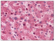 AM08416PU-N - Transthyretin / Prealbumin