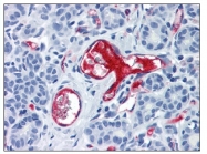 AM08419PU-N - von Willebrand factor (VWF)