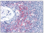 AM08420PU-N - CD54 / ICAM1