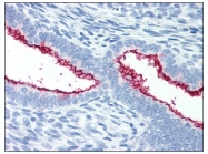 AM08425PU-N - Mucin-16 / CA125