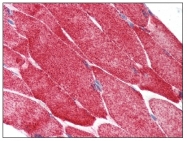 AM08290PU-N - HSPB1 / HSP27