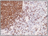 AM08277PU-N - CD20