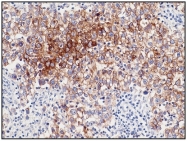 AM08281PU-N - Alkaline phosphatase / PLAP / ALPP