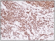 AM08282PU-N - Estrogen receptor alpha