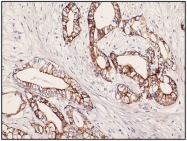 AM08288PU-N - Cytokeratin 7