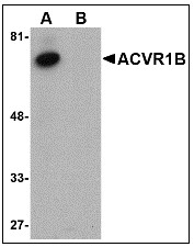 AP08925PU-N - Activin receptor type 1 / ACRV1