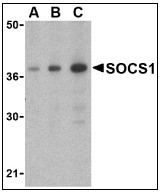AP08927PU-N - SOCS1