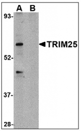AP08929PU-N - TRIM25 / RNF147