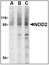 AP08943PU-N - CARD15 / NOD2