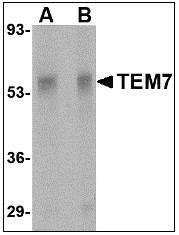 AP08948PU-N - PLXDC1 / TEM7