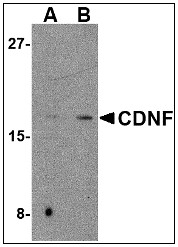 AP08950PU-N - CDNF