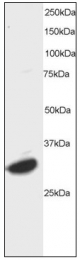 AP08952PU-N - ATF7