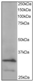 AP08957PU-N - ARPC2 / ARC34