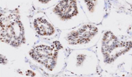 AM09028PU-N - Protein phosphatase 1G / PPM1G