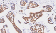 AM09087PU-N - Tomoregulin-2 / TMEFF2