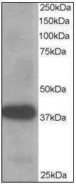 AP08960PU-N - AKR1A1 / ALDR1