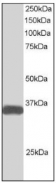 AP08962PU-N - STRAD beta / ILPIP
