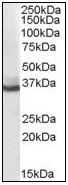 AP08974PU-N - AKR1C4