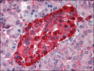 AP08891PU-N - Transthyretin / Prealbumin